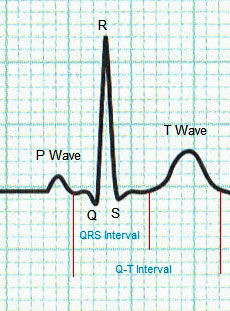Normal Heart ECG Trace