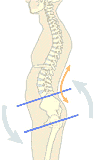 Muscle Imbalance